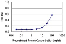 C21orf2 Antibody (clone 1E4)