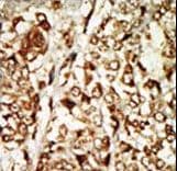 Polyclonal Rabbit anti-Human MOS Antibody (aa1-30, IHC, WB)