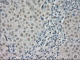NTRK3 / TRKC Antibody (clone OTI2B8)