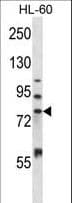 MMP15 Antibody (aa168-196)