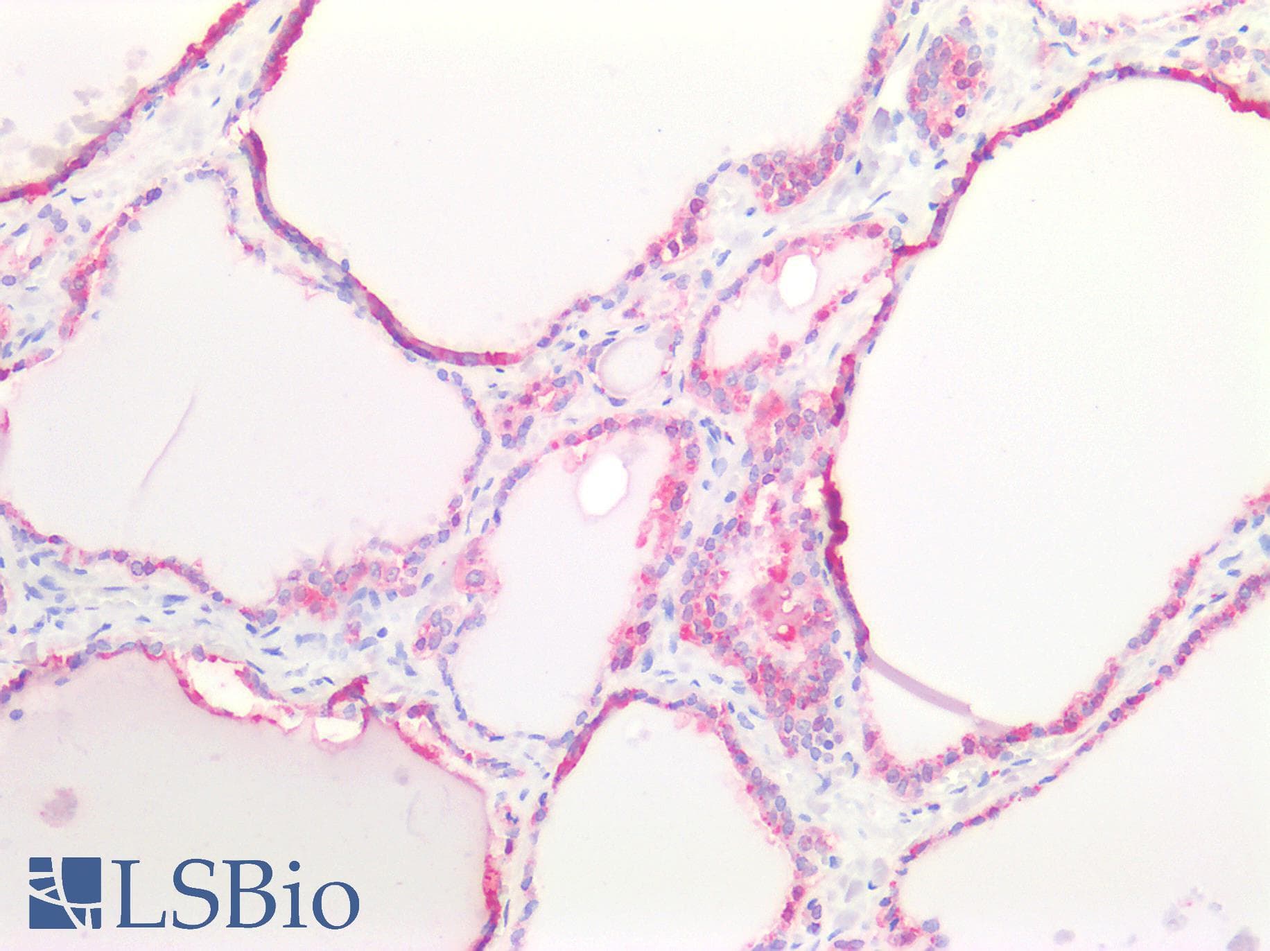 IHC-plus™ Polyclonal Rabbit anti-Human CTSB / Cathepsin B Antibody (IHC)
