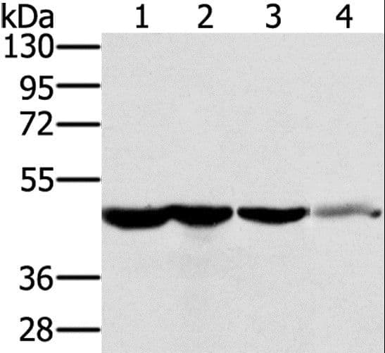 Polyclonal Rabbit anti-Human RNH1 Antibody (IHC, WB)