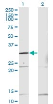 Monoclonal Mouse anti-Human HOXB1 Antibody (clone 2E5, WB)
