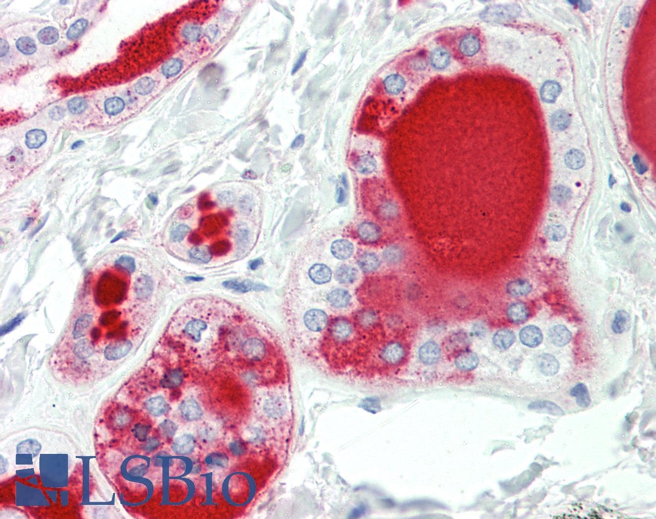 IHC-plus™ HAS3 Antibody (aa137-164)