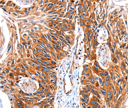 Polyclonal Rabbit anti-Human Rhodopsin Kinase / GRK1 Antibody (IHC, WB)