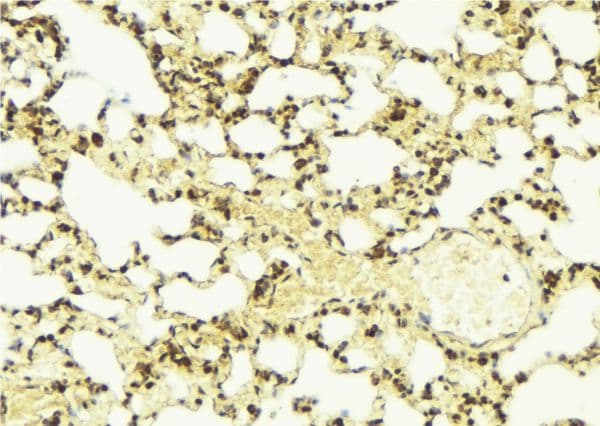 LBC / AKAP13 Antibody