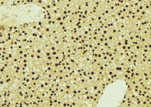 NDRG1 Antibody