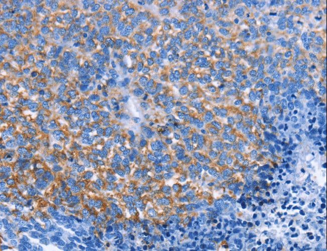 CXCL3 / GRO Gamma Antibody