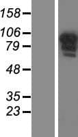 CCDC144B Protein (Over-Expression Lysate Myc-DDK (Flag))
