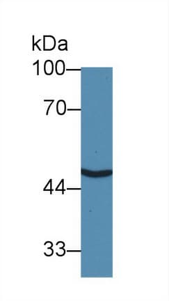 SLC30A8 / ZNT8 Antibody (aa1-80)