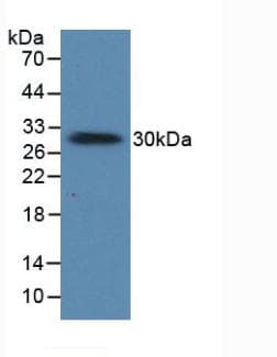 PRL / Prolactin Antibody (aa1-227, PE)