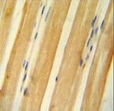 Polyclonal Rabbit anti-Human BTF / BCLAF1 Antibody (aa658-687, IHC, WB)