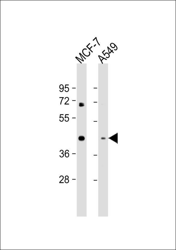 MVK Antibody