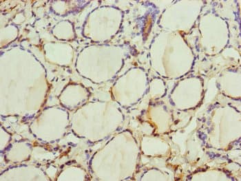 TRIM23 Antibody