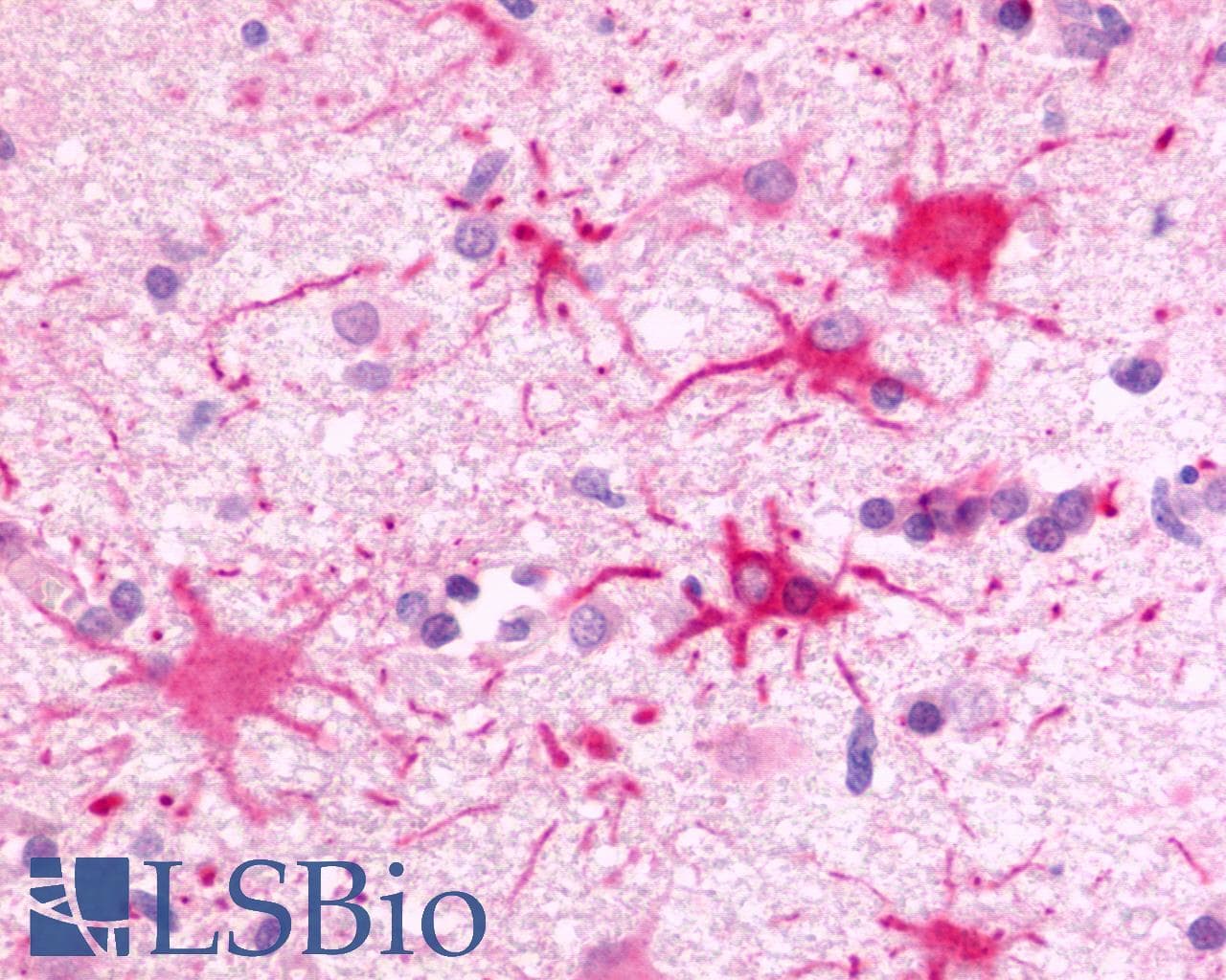 PathPlus™ Polyclonal Rabbit anti-Human FKSG80 / GPR81 Antibody (Extracellular Domain, IHC)