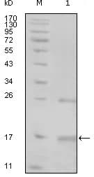 TNK1 Antibody (clone 1B5G3)