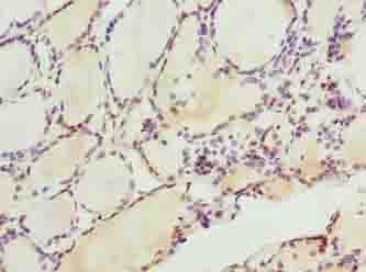 Polyclonal Rabbit anti-Human LACE1 Antibody (IHC, WB)