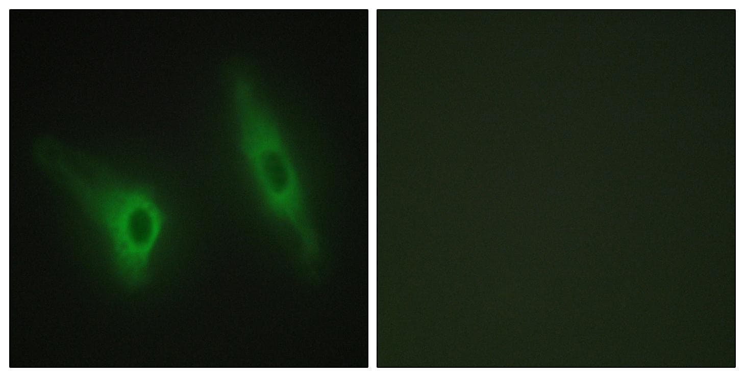 CSNK1E / CK1 Epsilon Antibody