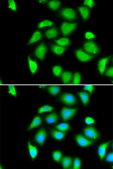 Polyclonal Rabbit anti-Human RPS5 / Ribosomal Protein S5 Antibody (IHC, IF, WB)