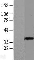 Human ASPA Protein (Over-Expression Lysate Myc-DDK (Flag))