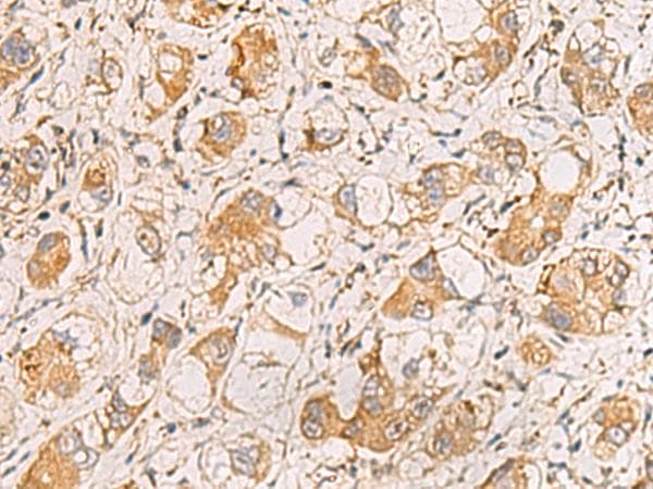 Polyclonal Rabbit anti-Human RAB38 Antibody (IHC, WB)
