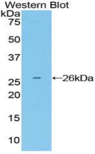GRB7 Antibody (aa298-489)