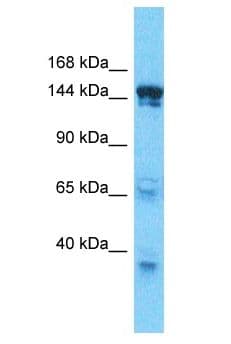 SMARCC2 Antibody (aa254-303)