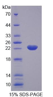 Rat KTN1 / Kinectin Protein (Recombinant His-T7)