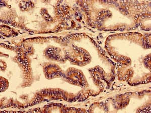Polyclonal Rabbit anti-Human YIF1B Antibody (aa1-153)