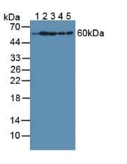 HPRT1 / HPRT Antibody (aa3-218)
