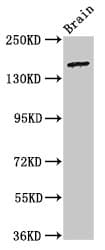 ADGRB2 / BAI2 Antibody