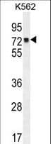 MLH1 Antibody (aa452-480)
