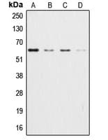 Polyclonal Rabbit anti-Human AKT1 + AKT2 + AKT3 Antibody (Internal, IHC, WB)