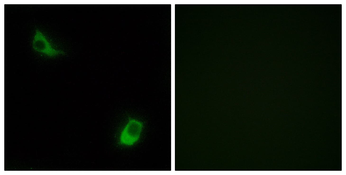 FPR3 / FPRL2 Antibody (aa304-353)