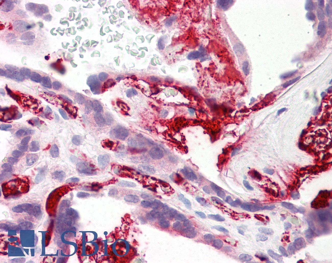 Polyclonal Rabbit anti-Human FGA / Fibrinogen Alpha Antibody (C-Terminus, IHC, WB)