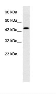 Polyclonal Rabbit anti-Human CALR / Calreticulin Antibody (aa342-391, IHC, WB)
