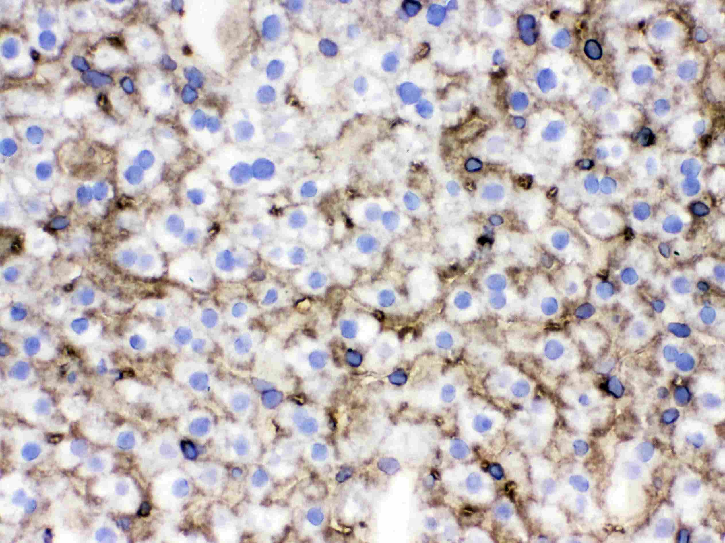 Polyclonal Rabbit anti-Mouse SLC10A1 / NTCP Antibody (aa296-336, IHC, WB)