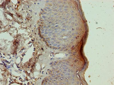 Polyclonal Rabbit anti-Human NR2C2AP / TRA16 Antibody (IHC, WB)