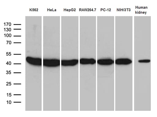 Monoclonal Mouse anti-Human RPSA / Laminin Receptor Antibody (clone OTI1G3, aa2-295, IHC, WB)