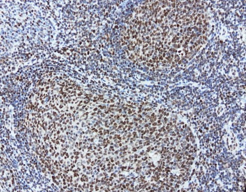 MEF2C Antibody (clone UMAB17)