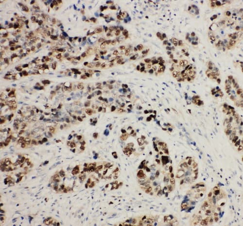 Polyclonal Rabbit anti-Human MCM2 Antibody (aa889-904, IHC, WB)