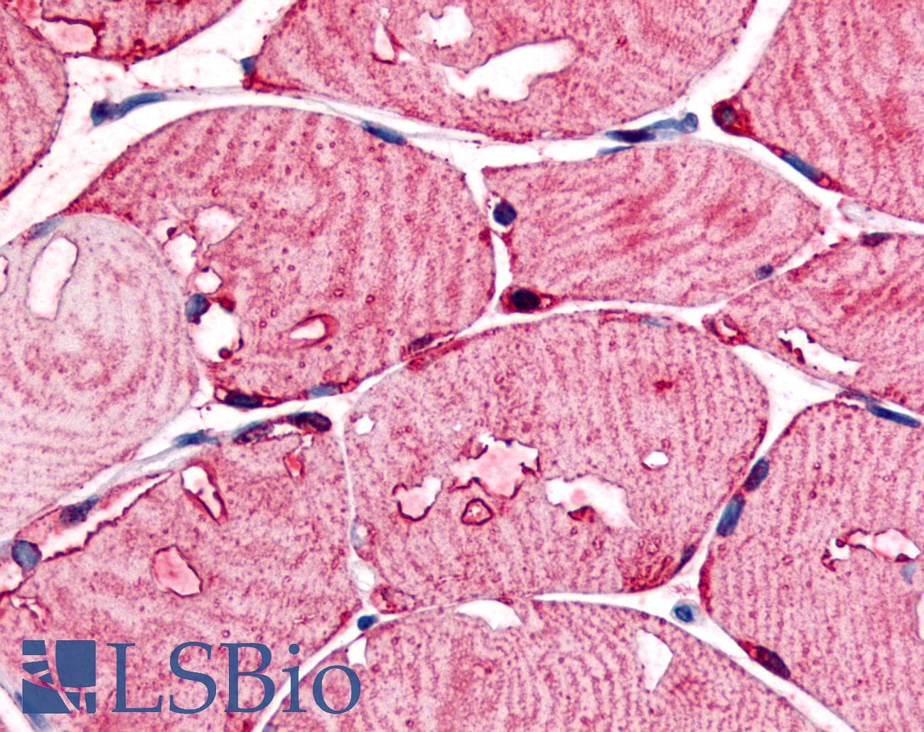 IHC-plus™ Polyclonal Rabbit anti-Human USP2 Antibody (Internal, IHC)
