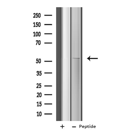 CYP4X1 Antibody