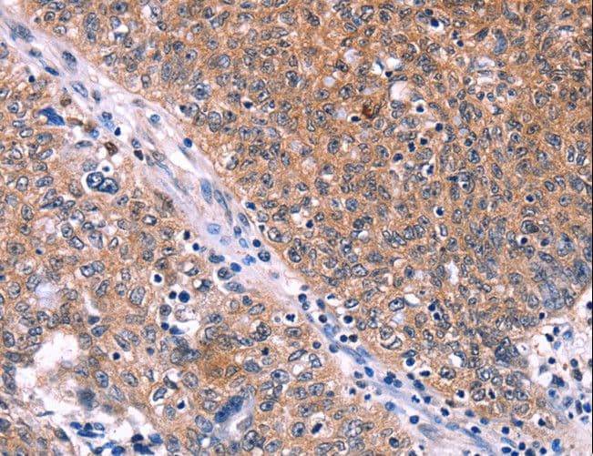 EDN1 / Endothelin 1 Antibody
