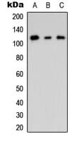 CNKSR2 Antibody (Internal)