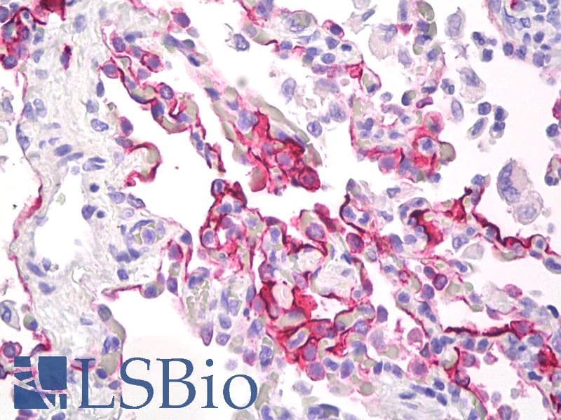 IHC-plus™ EMA / MUC1 Antibody (clone 175C5)
