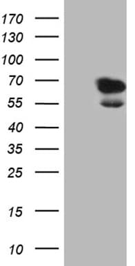 Monoclonal Mouse anti-Human LAD1 Antibody (clone OTI7H8, Carrier-free, aa271-517, IHC, WB)