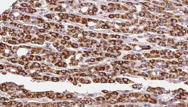 ADRB3 Antibody