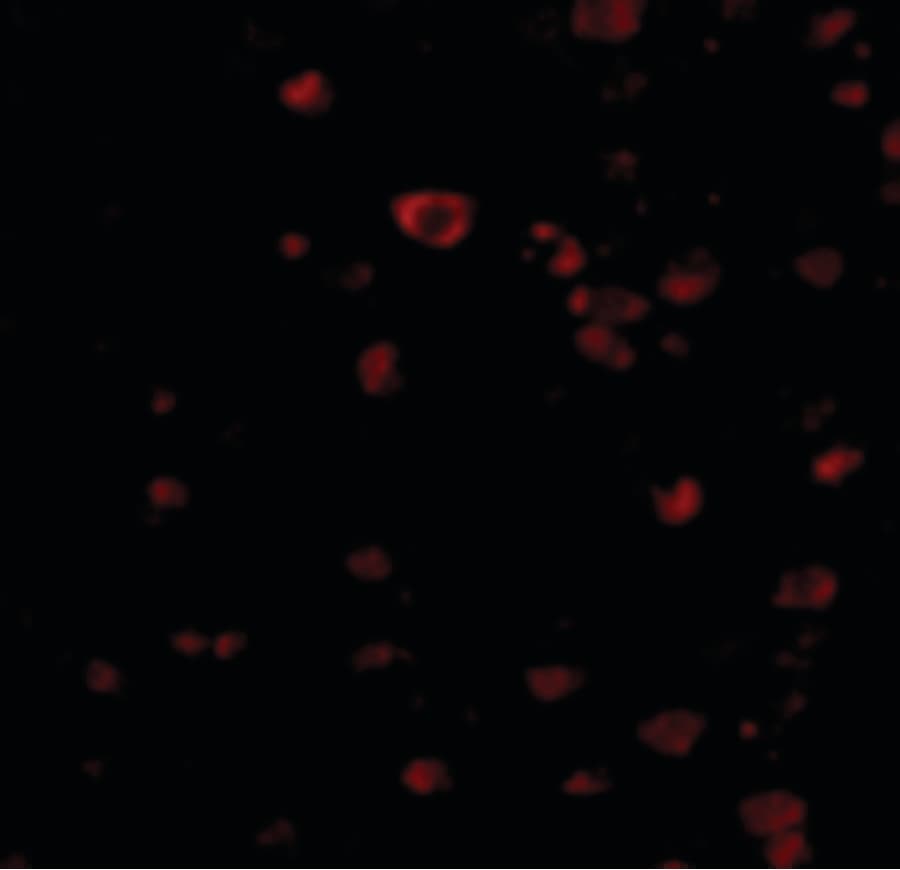 IHC-plus™ Polyclonal Rabbit anti-Human KIAA1811 / BRSK1 Antibody (IHC, IF, WB)