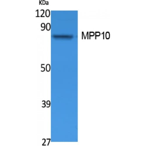 Polyclonal Rabbit anti-Human MPHOSPH10 / MPP10 Antibody (60-140 aa, Internal, WB)